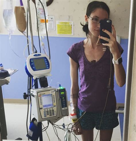 Anorexics Skeletal Body Was So Tiny Nurses Confused Her For Aids