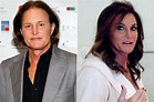 Caitlyn (Bruce) Jenner plastic surgery for total face change