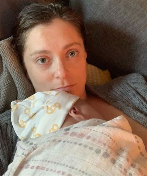 Rachel Bloom Shares Before And After Photos From Breast Reduction
