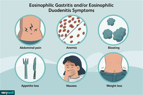 Eosinophilic Gastritis Andor Eosinophilic Duodenitis Causes Symptoms