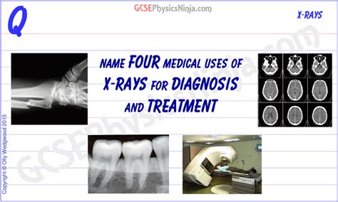 33 Medical Uses Of X Rays