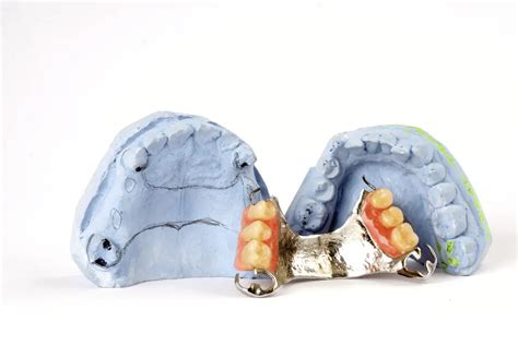 Partial Dentures Restoring Your Smile And Confidence