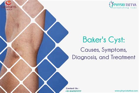 Bakers Cyst Causes Symptoms And Treatment