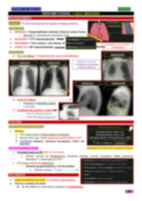 Derrame Pleural Gua No Pulm O Causas Gravidade E Como Tratar My Xxx