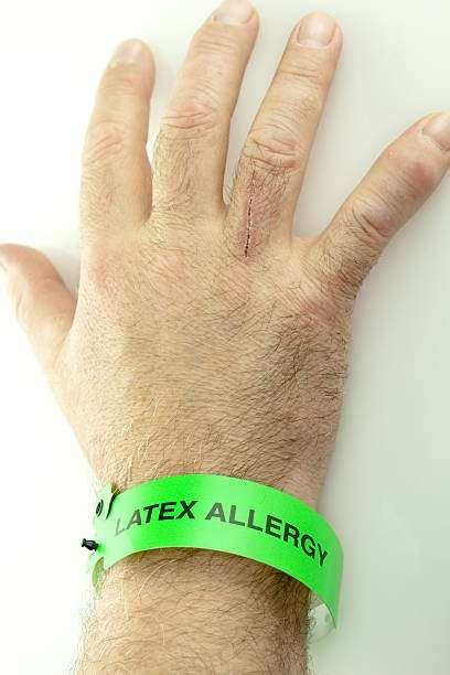 How Common Is Latex Allergy Know Your Allergy