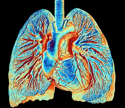 Pulmonary Vasculature News Research Studies Pvd Clinical Results