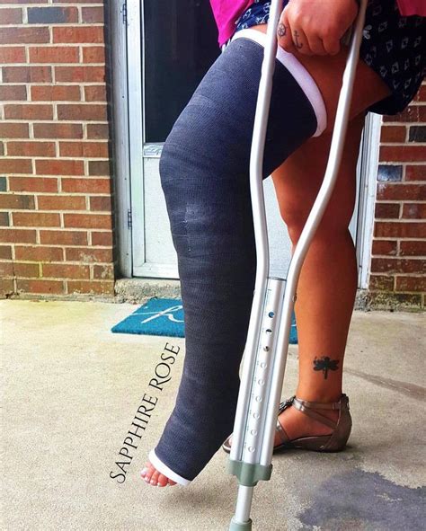 Sapphirerosexx Tumblr Com Long Leg Cast Leg Cast Long Legs
