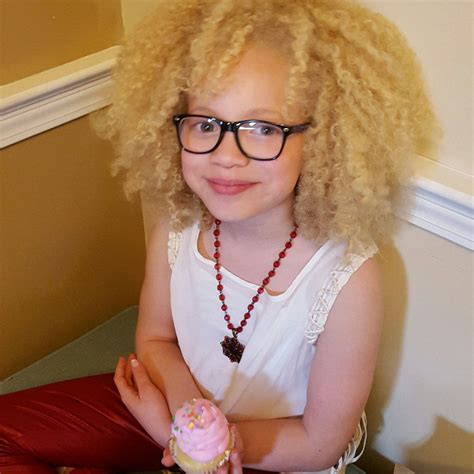 Albino Models And Black Women Hairstyles Ava Clarke Mens Short Curly