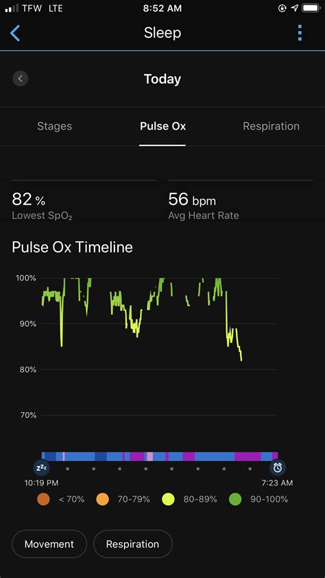 How Accurate Is The Pulse Ox Should I See My Doctor Rgarmin