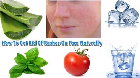 Pin On How To Get Rid Of Rashes On Face Naturally