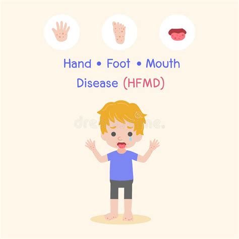 Hand Foot And Mouth Disease Hfmd Medical Health Care Concept Stock