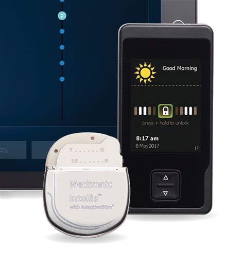 Medtronic Announces Fda Approval And Us Launch Of Next Generation