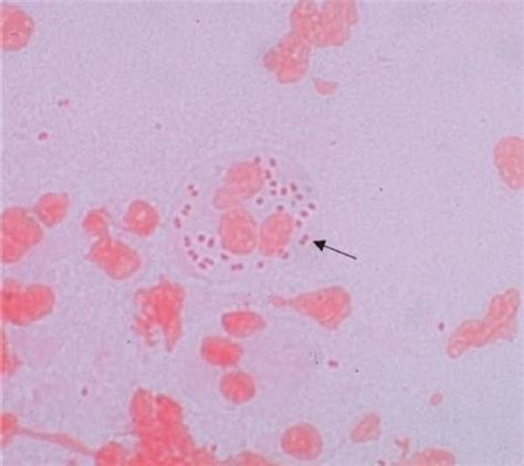 Gram Negative Cocci Review Of Medical Microbiology And Immunology