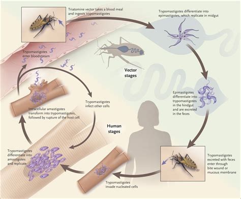 Chagas Disease In California - Quotes Welcome