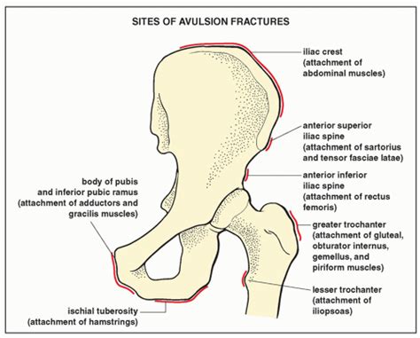 Lower Limb I: Pelvic Girdle, Sacrum, and Proximal Femur ...