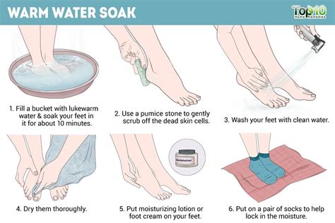 How To Get Rid Of Peeling Skin On Your Feet Top 10 Home