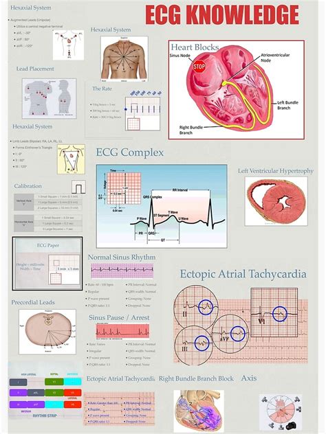 Ecg Knowledge Poster For Sale By World Anatom Redbubble