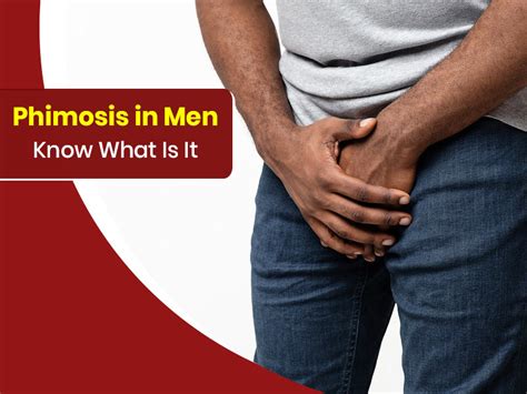 Phimosis In Men Know Symptoms Causes And Treatment Options Onlymyhealth