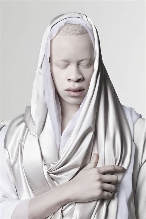 Justin Dingwall S Portfolio Albus Albino Model Albinism Albino