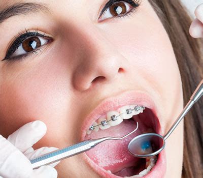 What does the literature say? How Long Do I Have to Wear Braces? | The Brace Place ...