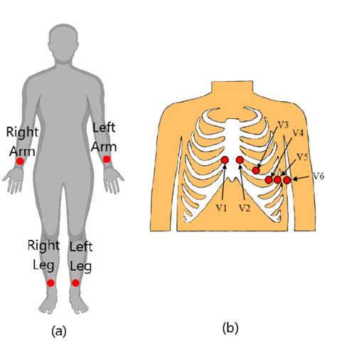 Possible Electrode Placements For Ecg Recordings 19 A Electrode