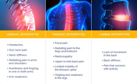 Disc Osteophyte Complex Causes Symptoms And Treatment Bonati