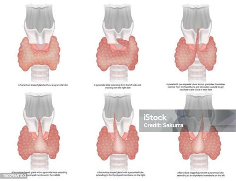Ilustrasi Klasifikasi Bentuk Kelenjar Tiroid Variasi Anatomi Dan Jenis