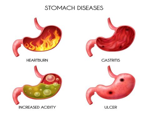 a guide on digestive disorders and role of gastroenterologists by digestive disease medium
