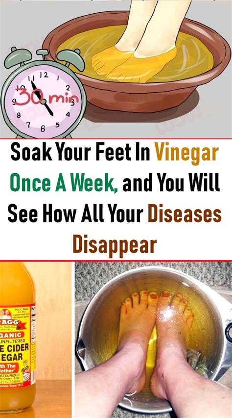 7 Amazing Health Advantages Of Apple Cider Vinegar Foot Soak Apple