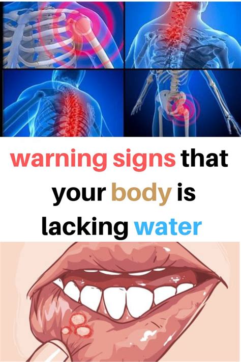 10 Warning Signs That Your Body Is Lacking Water Health Wellness