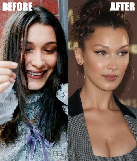 How did bella hadid look like before modeling? Bella Hadid Plastic Surgery Secrets EXPOSED! 2020