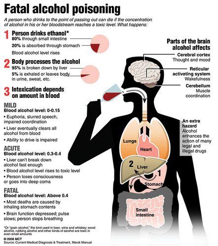 Stages Of Alcohol Poisoning Its Causes And Treatments