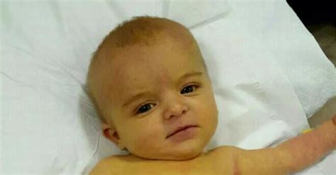 Baby Who Turned Yellow After Getting Rare Liver Disease At Three Days Old Survives After