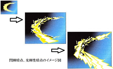 閃輝暗点せんきあんてんの原因予防と対処方法 トリビアーノ