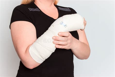Young Female With Broken Hand In Cast Stock Image Image Of Broken