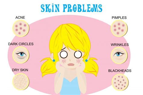 Skin Problem Troubled Woman And Set Of Most Common Female Facial Skin