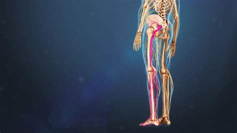 Sciatica Getting To The Root Of Pinched Nerve Pain Bellevue Pain And