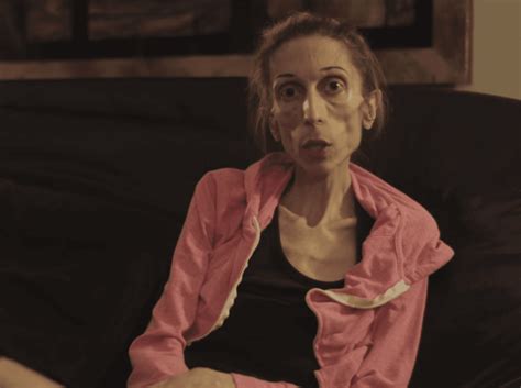 I Need Your Help Video Plea From Actress Dying Of Anorexia