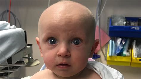 Child Cancer Survivor New Treatment Helped Baby Survive Tumour Daily