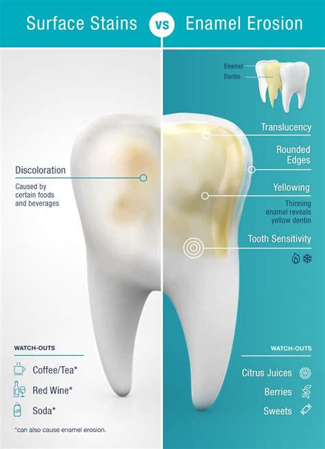 Stained Teeth Or Enamel Erosion Pronamel® Toothpaste