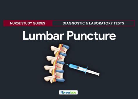 Lumbar Puncture Spinal Tap Nursing Responsibilities Nurseslabs