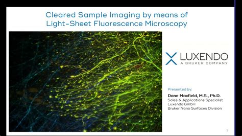 Light Sheet Microscopy Cleared Sample Imaging Bruker Youtube