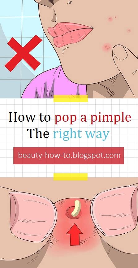 How To Pop A Pimple The Right Way How To Beauty
