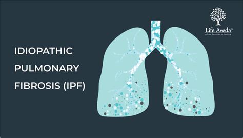 Idiopathic Pulmonary Fibrosis Causes Ayurvedic Treatment