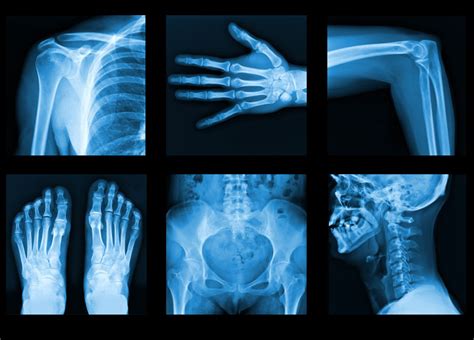 X Ray Houston Radiology Humble Tx X Ray Imaging