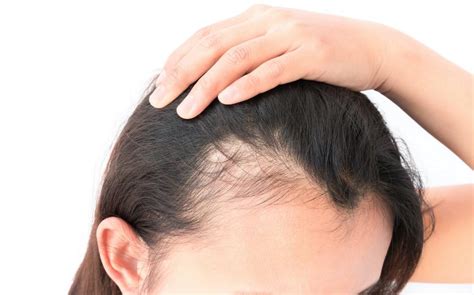 Reasons Why Your Hair Is Thinning Osteopathic Center For Healing