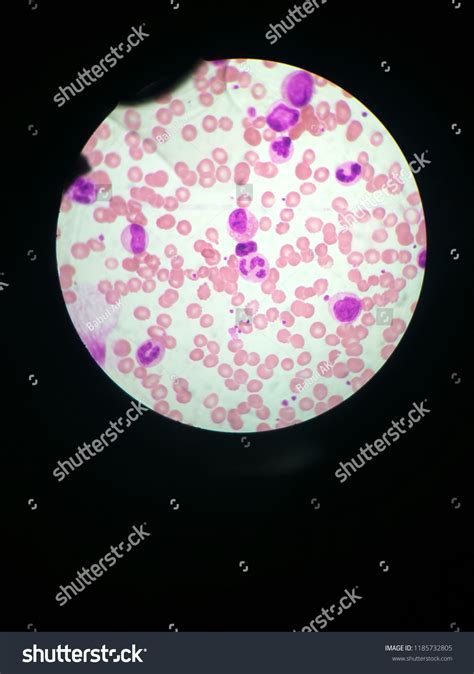 Red Blood Cells Monocytes Lymphocytes Neutrophils Stock Photo