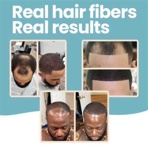 Hair Fibers For Bald Spot Concealer Hairline Beard Hair Loss By Hair