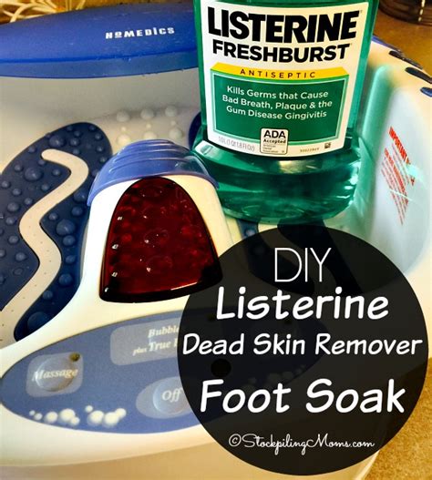 Diy Listerine Dead Skin Remover Foot Soak