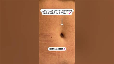 Tummy Tuck Belly Buttons And Abdominal Contour Youtube